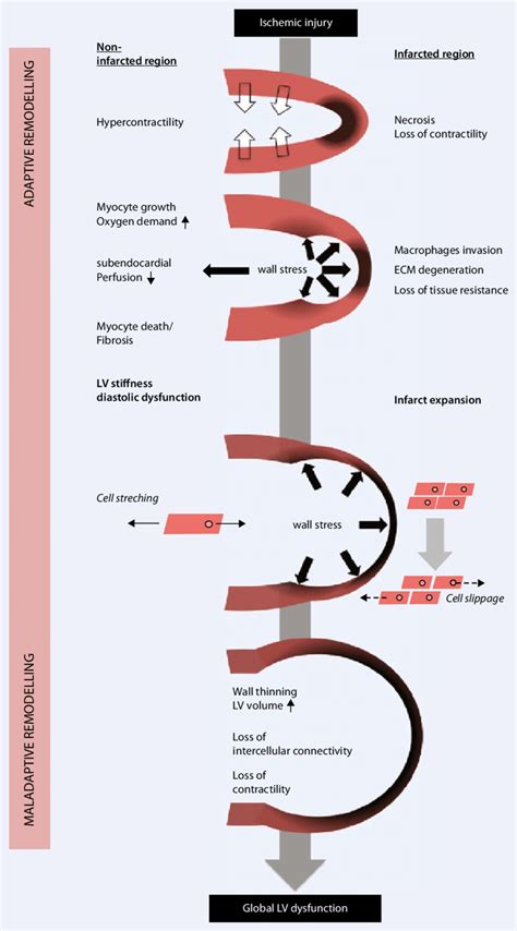 left ventricular remodeling process